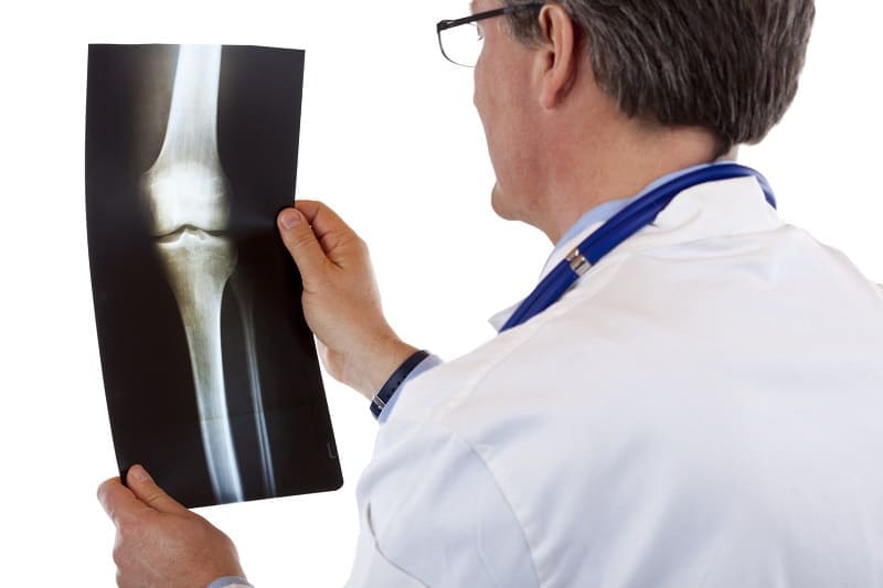 Ortopedista cerca de mí